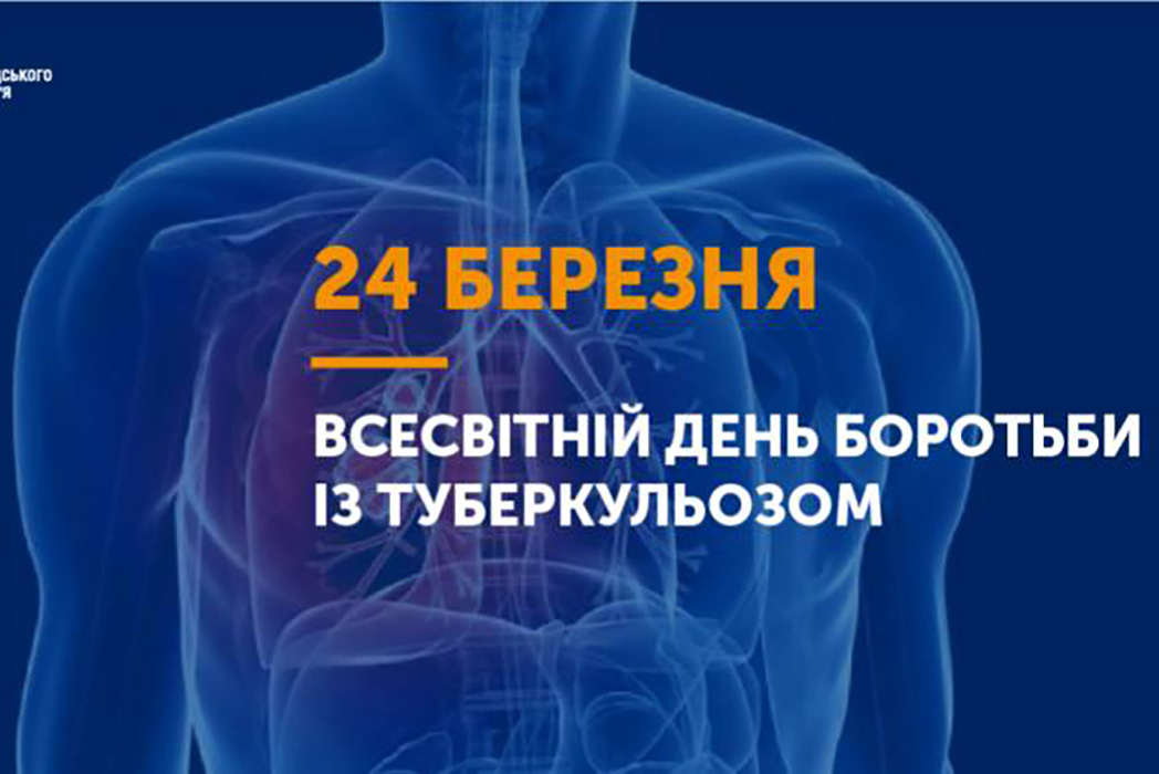 Read more about the article Туберкульоз і сьогодення,  в онлайн форматі