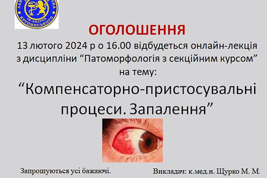 Детальніше про статтю Показове заняття викладача Щурко М.М. (13.02.2024)