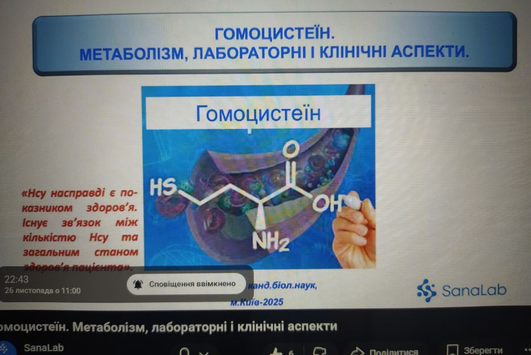 Детальніше про статтю Участь у лекції для лікарів-лаборантів та сімейних лікарів на тему: “Гомоцистеїн. Метаболізм, лабораторні і клінічні аспекти”.